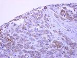 PACSIN1 Antibody in Immunohistochemistry (Paraffin) (IHC (P))