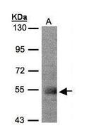 PACSIN1 Antibody in Western Blot (WB)