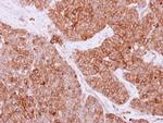 Rab4 Antibody in Immunohistochemistry (Paraffin) (IHC (P))