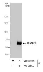 RASGRP2 Antibody in Immunoprecipitation (IP)