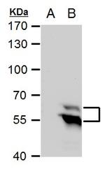 TdT Antibody in Western Blot (WB)