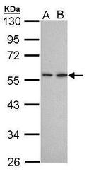 DPP2 Antibody in Western Blot (WB)