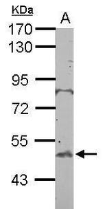 BTBD10 Antibody in Western Blot (WB)