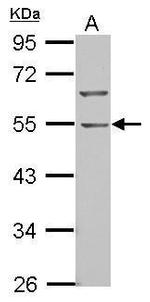 BTBD10 Antibody in Western Blot (WB)