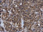 GSTM5 Antibody in Immunohistochemistry (Paraffin) (IHC (P))