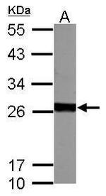 GSTM5 Antibody in Western Blot (WB)