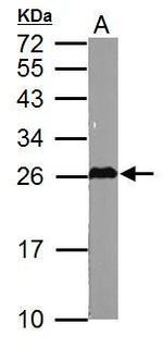 GSTM5 Antibody in Western Blot (WB)