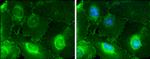 CD146 Antibody in Immunocytochemistry (ICC/IF)