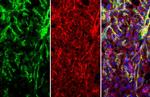 CD146 Antibody in Immunohistochemistry (Paraffin) (IHC (P))