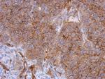 CD146 Antibody in Immunohistochemistry (Paraffin) (IHC (P))