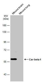 CACNB1 Antibody in Western Blot (WB)
