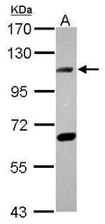 DNA ligase IV Antibody in Western Blot (WB)