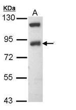 SCNN1B Antibody in Western Blot (WB)