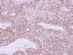 XPD Antibody in Immunohistochemistry (Paraffin) (IHC (P))