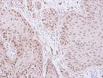 GTF2E2 Antibody in Immunohistochemistry (Paraffin) (IHC (P))