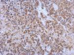 GP130 Antibody in Immunohistochemistry (Paraffin) (IHC (P))