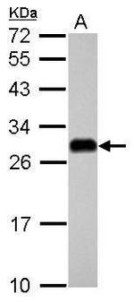 ETHE1 Antibody in Western Blot (WB)