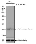 Glutamine Synthetase Antibody
