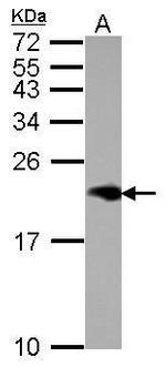 NPC2 Antibody in Western Blot (WB)