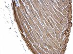 Cardiac Troponin I Antibody in Immunohistochemistry (Paraffin) (IHC (P))