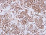 MMP16 Antibody in Immunohistochemistry (Paraffin) (IHC (P))