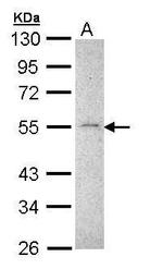 MMP16 Antibody in Western Blot (WB)