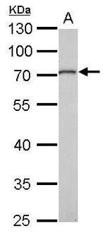 MMP16 Antibody in Western Blot (WB)