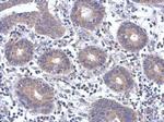 Fyn Antibody in Immunohistochemistry (Paraffin) (IHC (P))