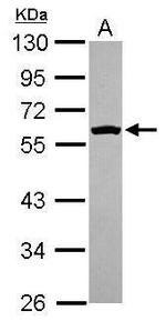 Fyn Antibody in Western Blot (WB)