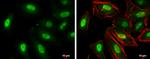 TKTL1 Antibody in Immunocytochemistry (ICC/IF)