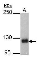 SCAP Antibody in Western Blot (WB)