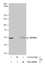 RUVBL1 Antibody in Immunoprecipitation (IP)