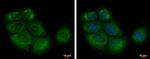 eIF2b alpha Antibody in Immunocytochemistry (ICC/IF)