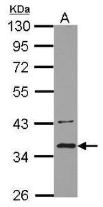 BRCC3 Antibody in Western Blot (WB)