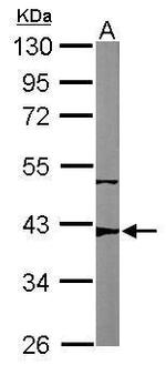 p53R2 Antibody in Western Blot (WB)