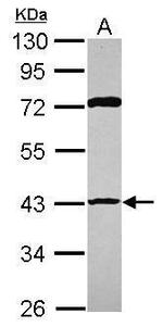 p53R2 Antibody in Western Blot (WB)