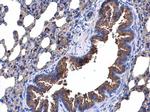 p53R2 Antibody in Immunohistochemistry (Paraffin) (IHC (P))