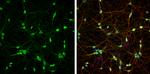 PGP9.5 Antibody in Immunocytochemistry (ICC/IF)