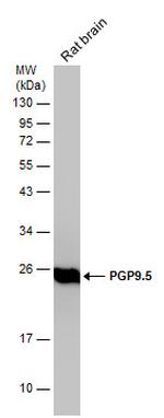 PGP9.5 Antibody in Western Blot (WB)