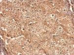 CCR6 Antibody in Immunohistochemistry (Paraffin) (IHC (P))