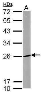 RAB5 Antibody in Western Blot (WB)