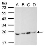 RAB5 Antibody in Western Blot (WB)