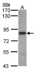 SH3BP2 Antibody in Western Blot (WB)