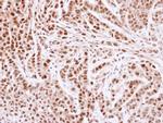 MCM4 Antibody in Immunohistochemistry (Paraffin) (IHC (P))