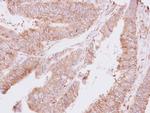 TARS Antibody in Immunohistochemistry (Paraffin) (IHC (P))