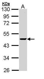 PPM1A Antibody in Western Blot (WB)