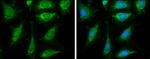 DLAT Antibody in Immunocytochemistry (ICC/IF)