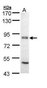 eIF2b epsilon Antibody in Western Blot (WB)