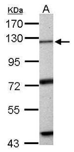 EXO1 Antibody in Western Blot (WB)