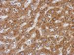 BAAT Antibody in Immunohistochemistry (Paraffin) (IHC (P))